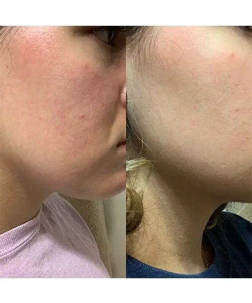 Beauty Edit-Multi Use Treatment Oil